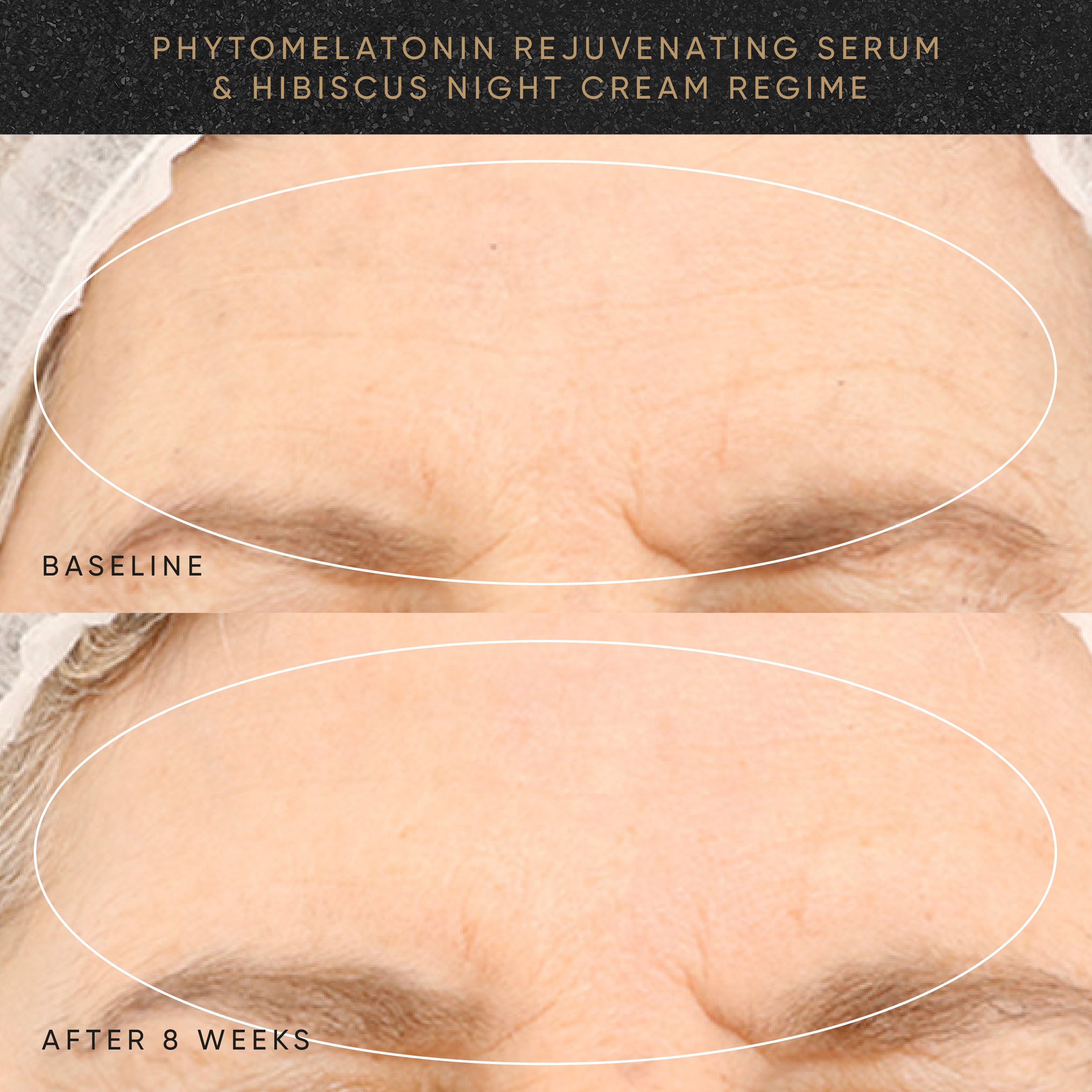 Before and after comparison of a woman&