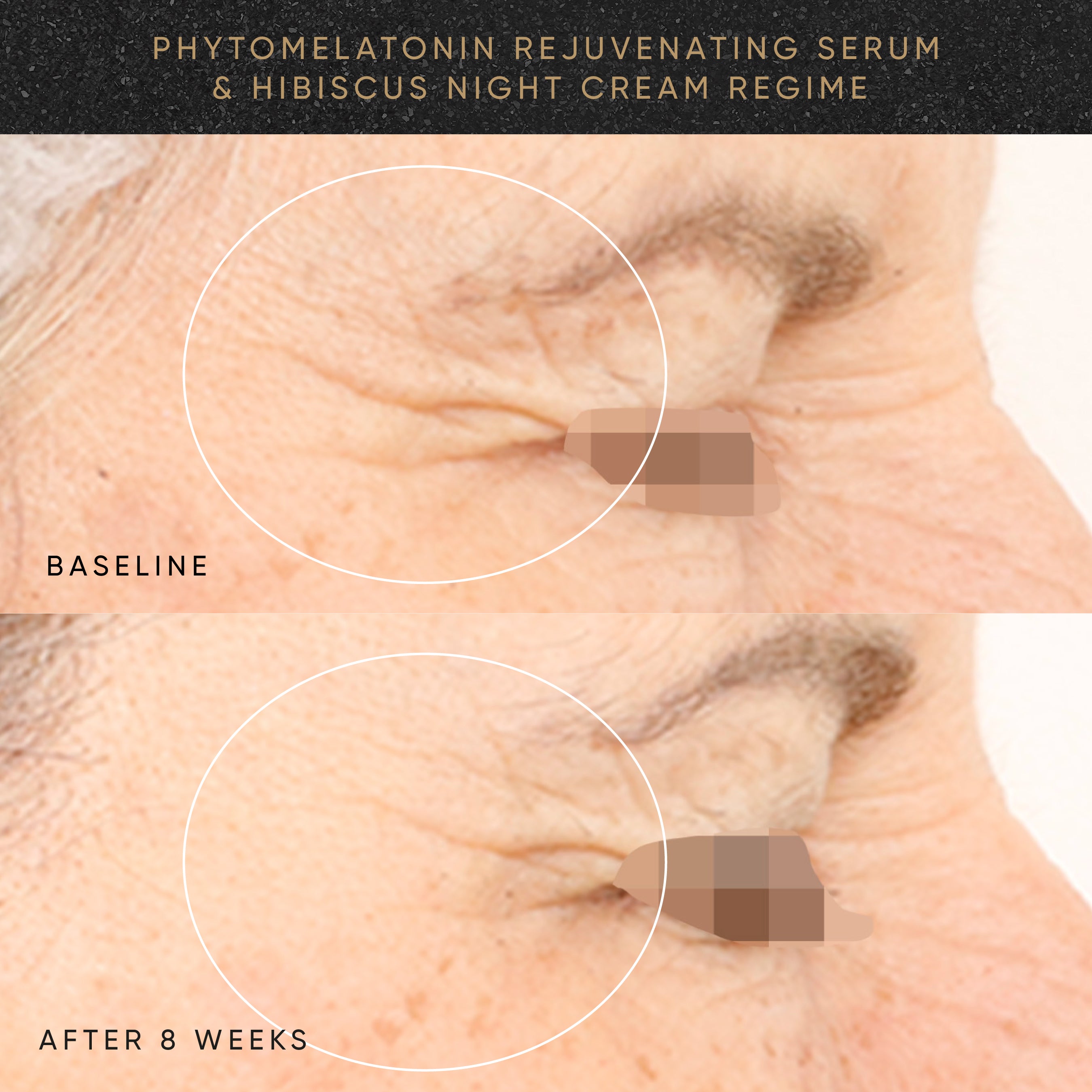 Wrinkle-Smoothing PM Travel-Size Kit