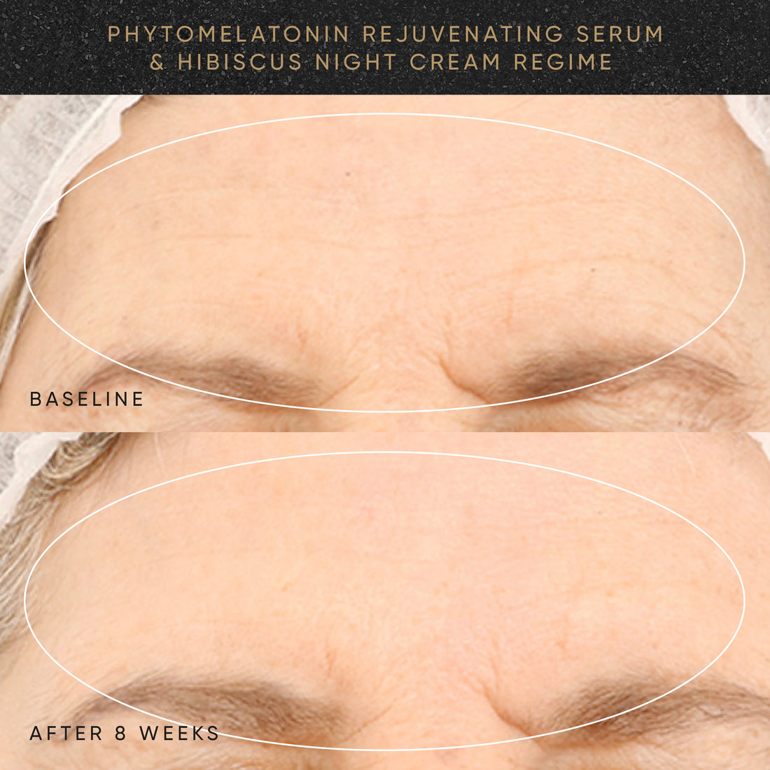 Wrinkle-Smoothing PM Travel-Size Kit